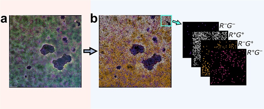 Topological Data Analysis of Pattern Formation in 2D Multichannel Microscopy Images
